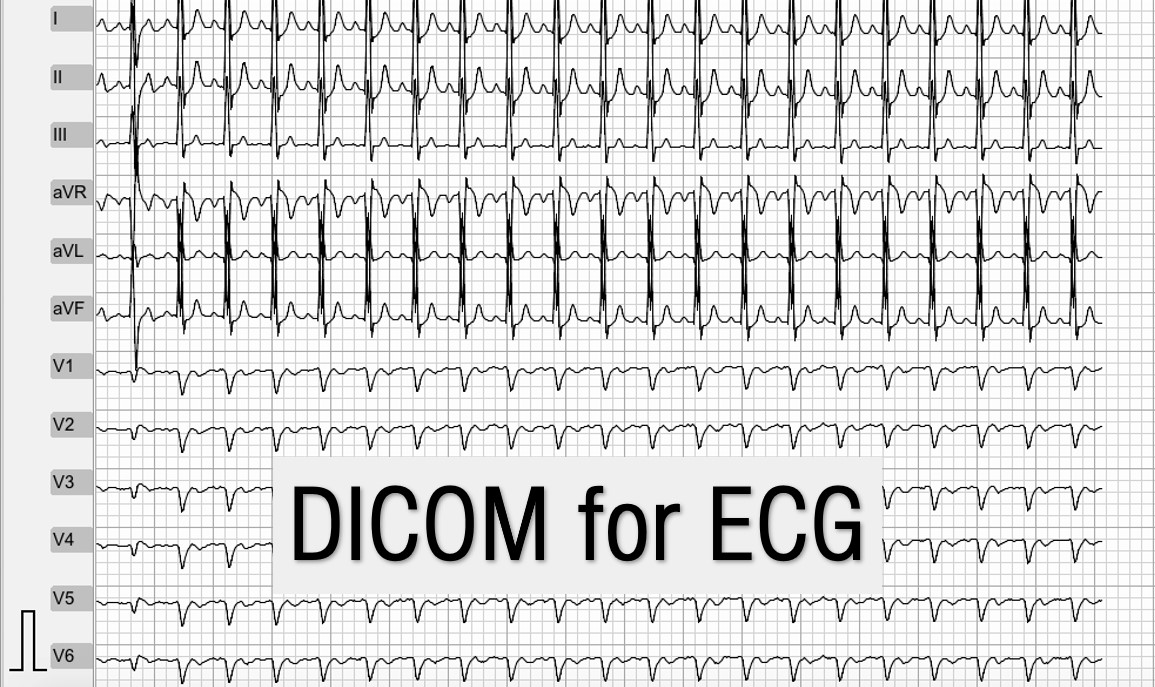 iOS Mobile App for ECG Viewing and ECG DICOM file Generation