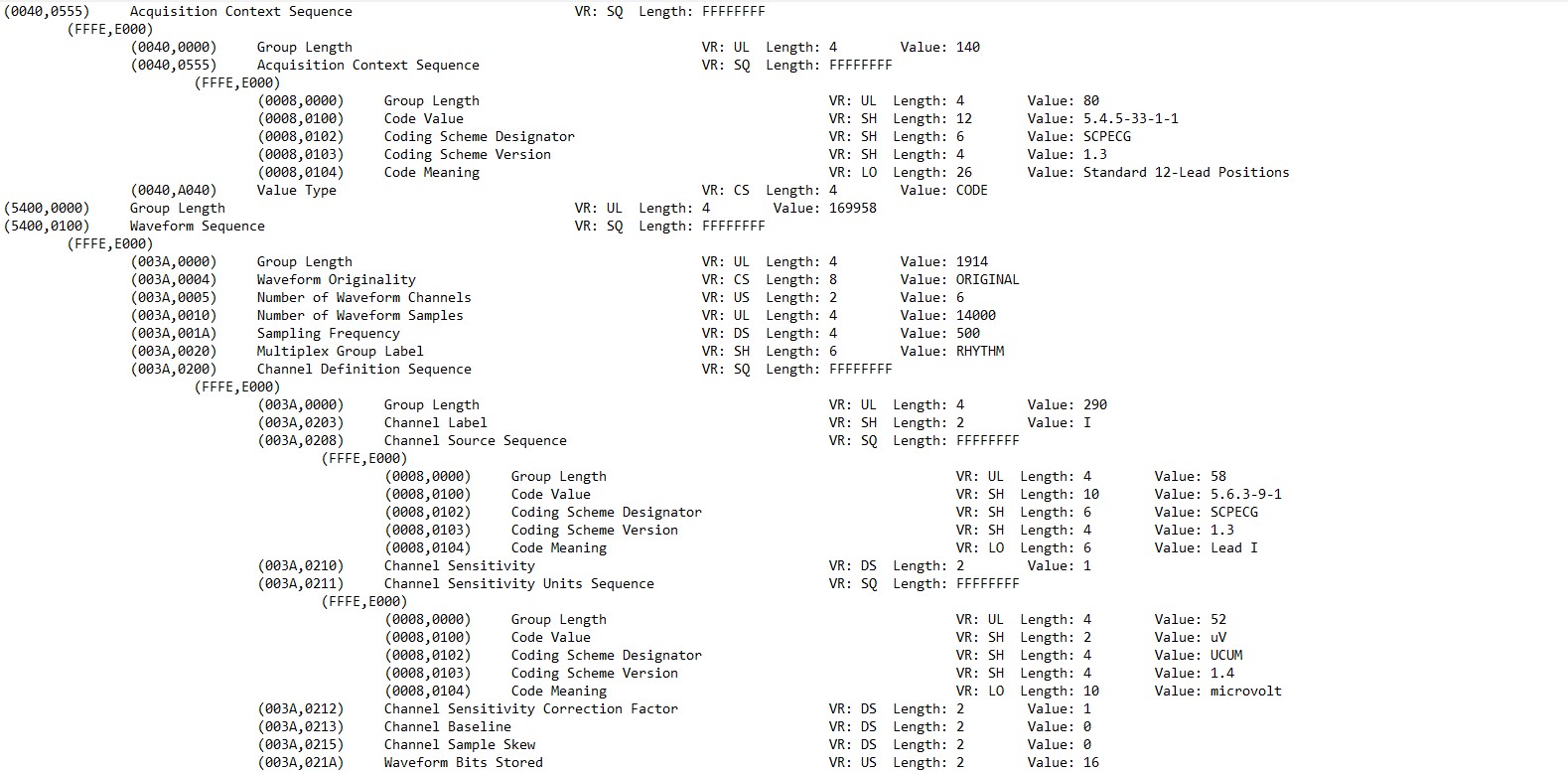Snippet of an ECG DICOM file
